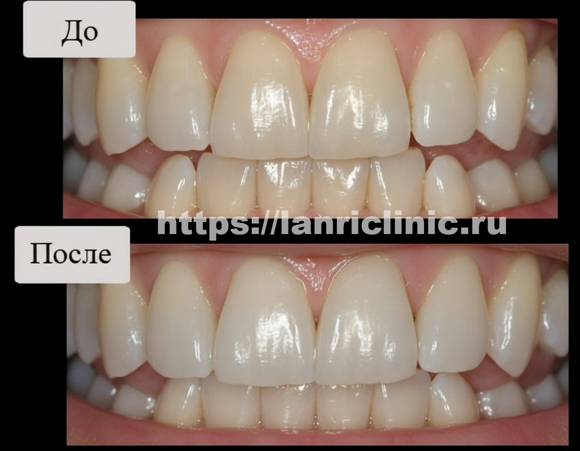 ������ ����� ������������