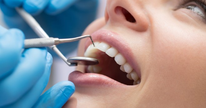 Цена лечения кариеса передних зубов в Ланри Клиник
