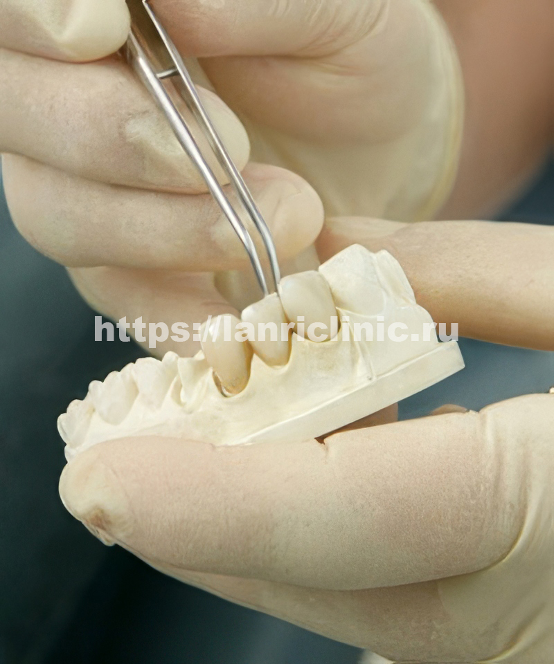 ���������� �������������� �����, ������ �������, ������ ����, ����������� �����