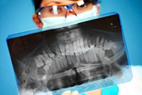 Рентген зуба, ортопантомограмма, удаление зубов, обезболивание зубов