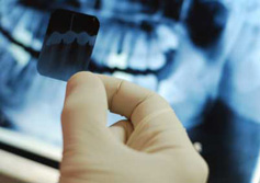 Рентген зуба, удаление зубов, обезболивание зубов